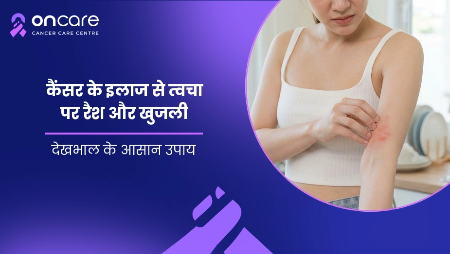 कैंसर के इलाज से त्वचा पर रैश और खुजली