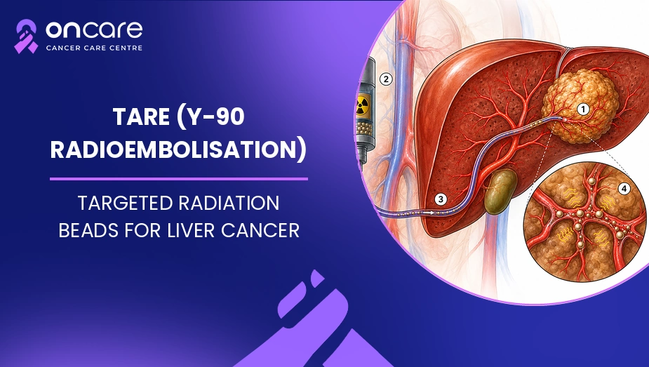 tare treatment for liver cancer