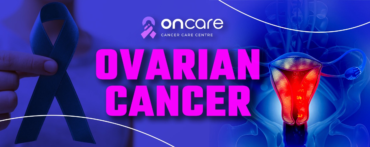 Ovarian Cancer