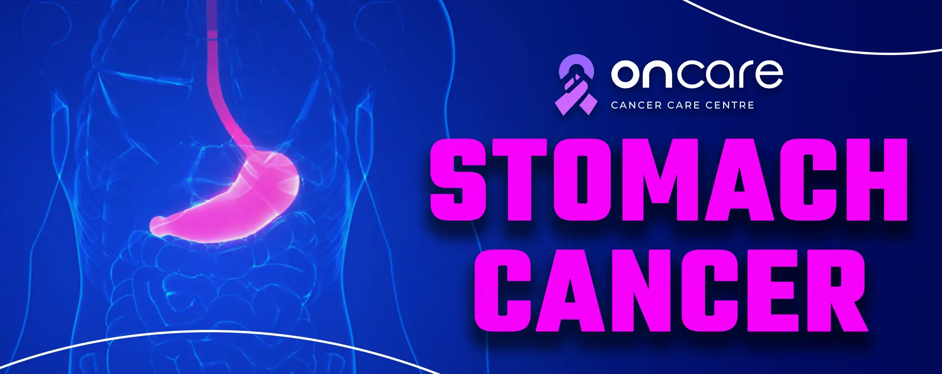 Stomach Cancer