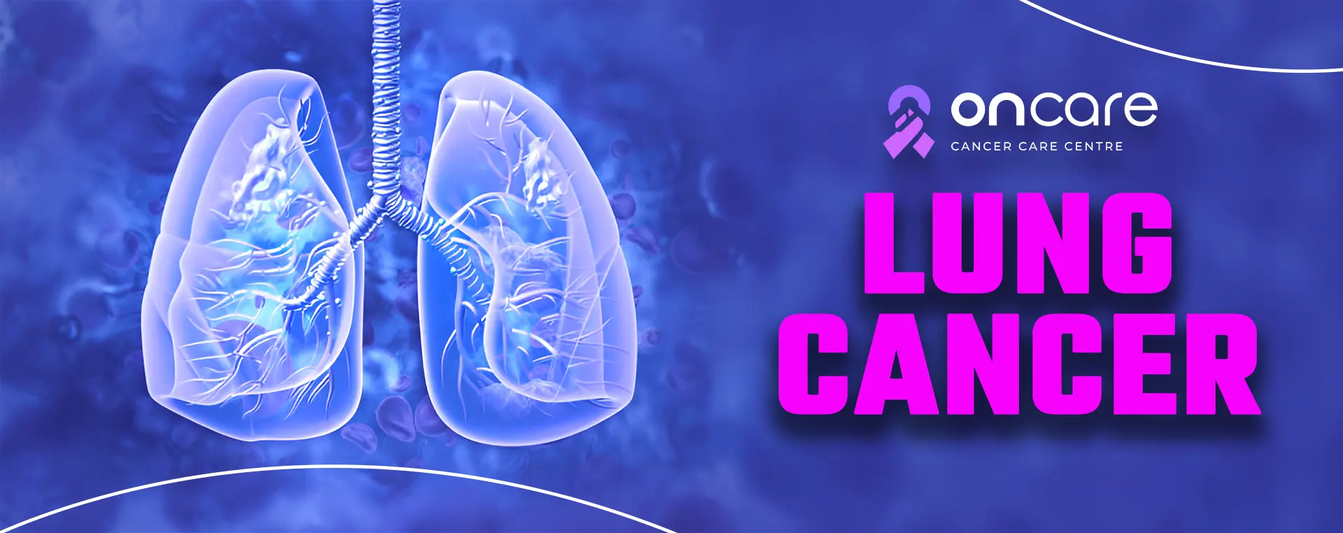 Lung Cancer