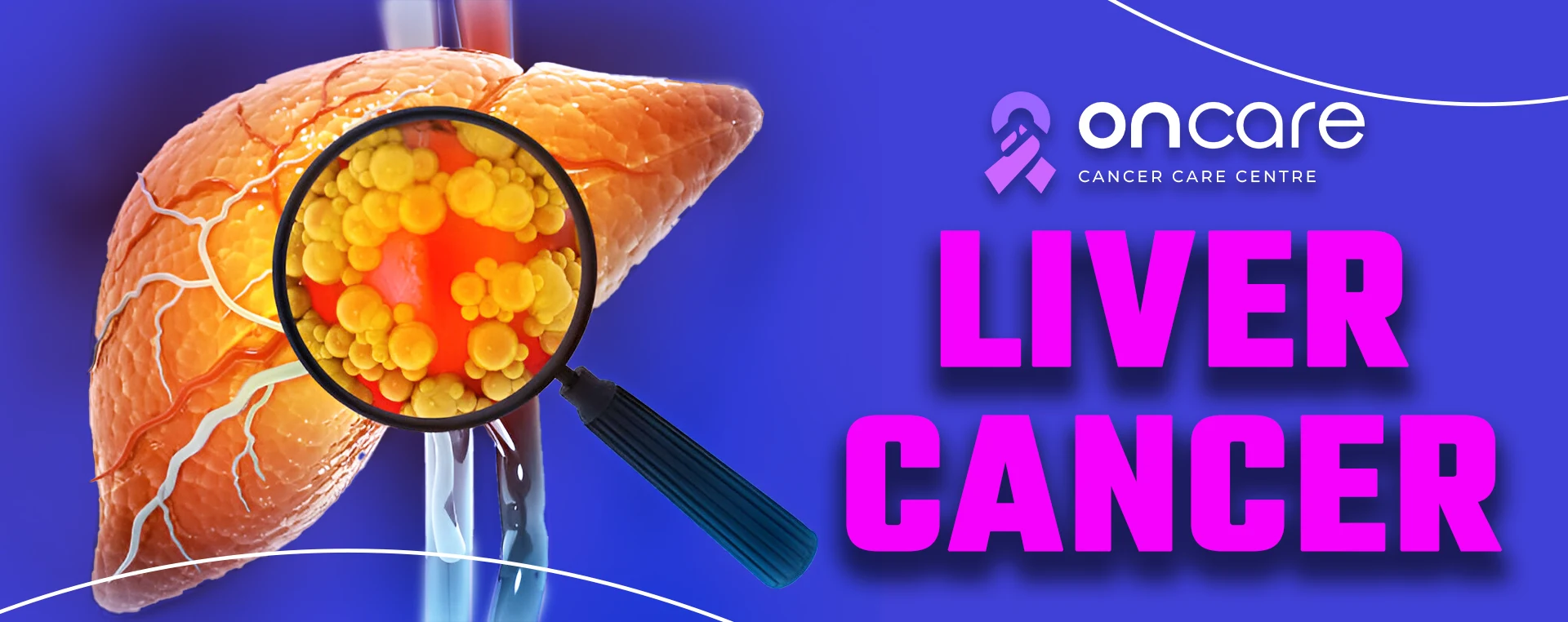 Liver Cancer