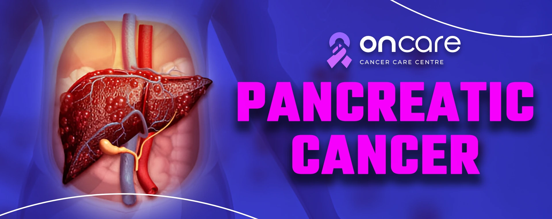 Pancreatic Cancer