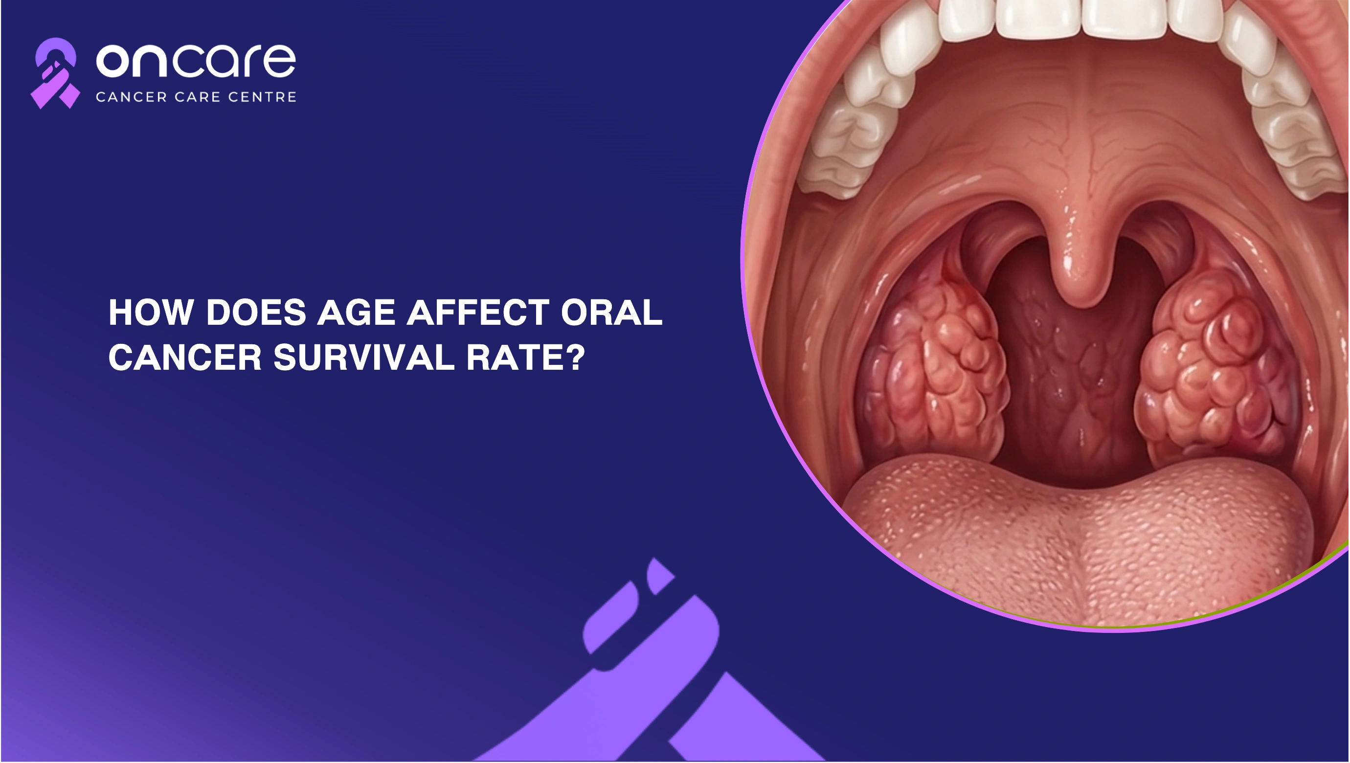 Teeth Cancer Symptoms: Early Signs to Watch for Oral Health