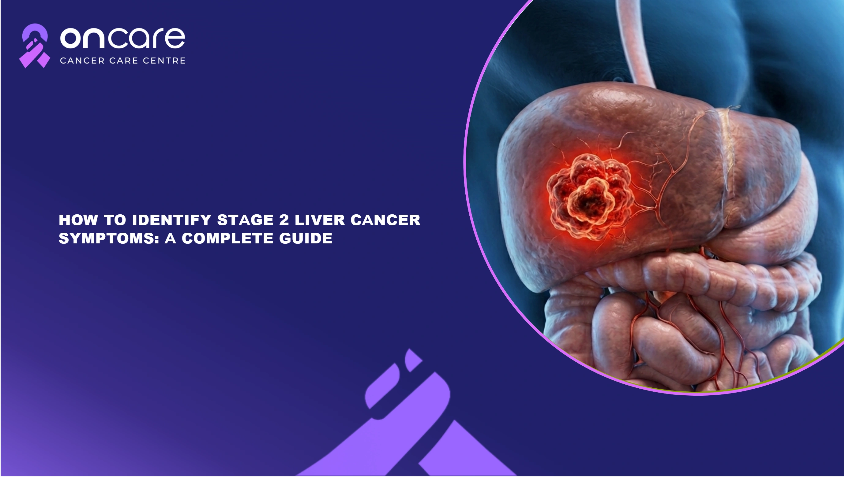 Stage 2 Cervical Cancer Treatment & Recovery | Oncare Hospital
