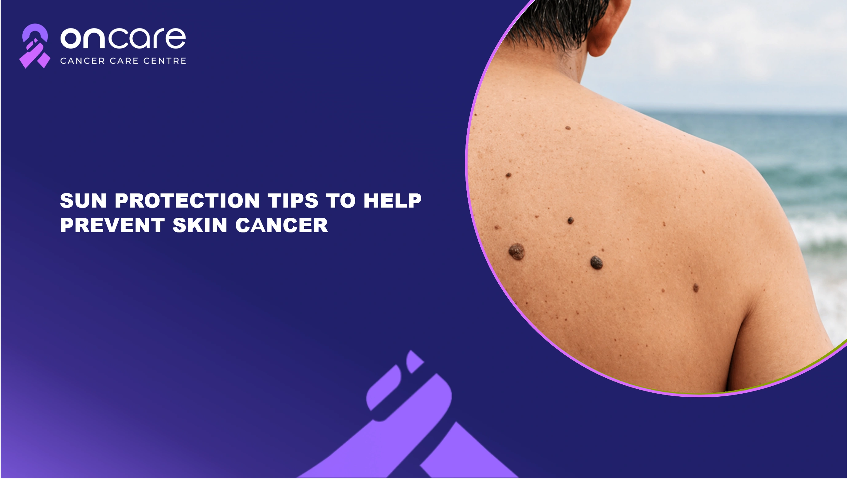 Leukemia Skin Symptoms | Oncare Cancer Hospital