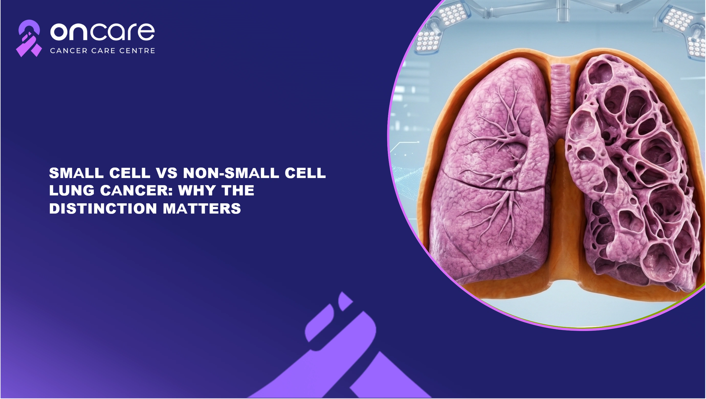 Lung Cancer Treatment in India: A Complete Guide | Oncare