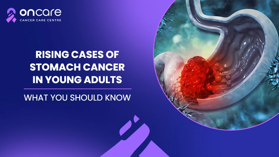 Rising Cases of Stomach Cancer in Young Adults: What You Should Know
