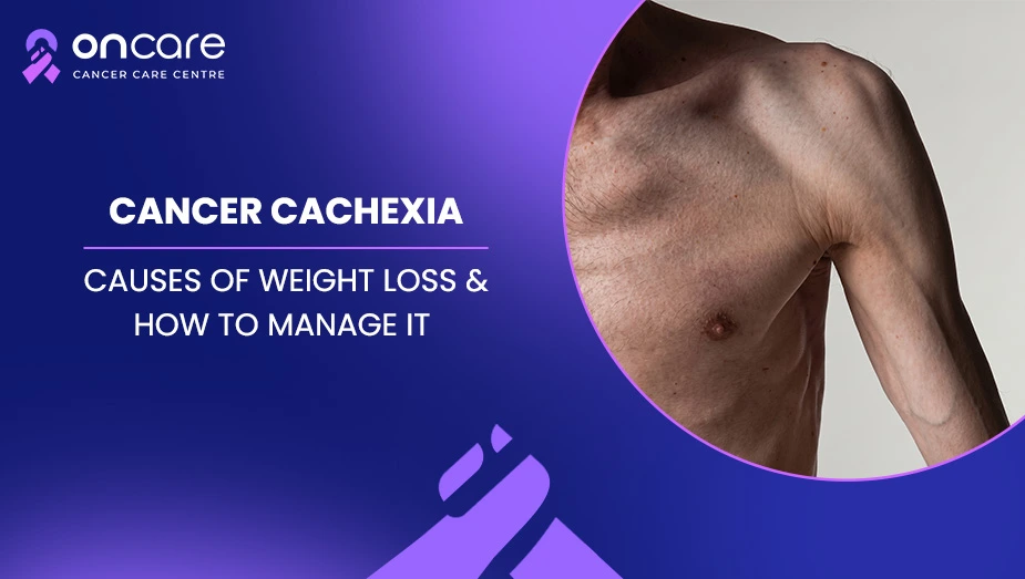 Cancer Cachexia: Causes of Weight Loss & How to Manage It
