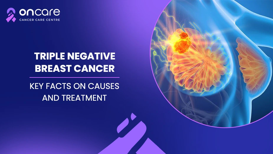 Triple Negative Breast Cancer: Key Facts on Causes and Treatment