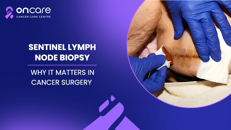 sentinel lymph node biopsy