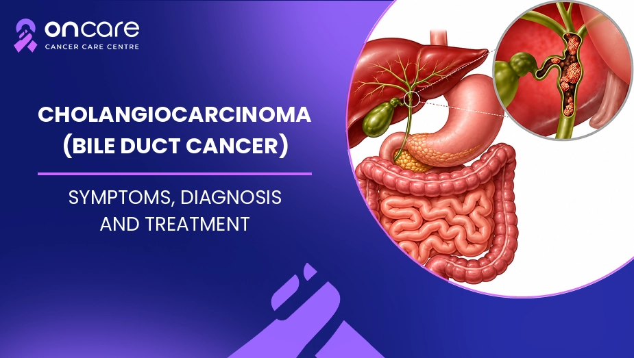 cholangiocarcinoma bile duct cancer