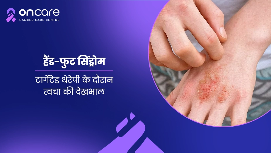 हैंड-फुट सिंड्रोम