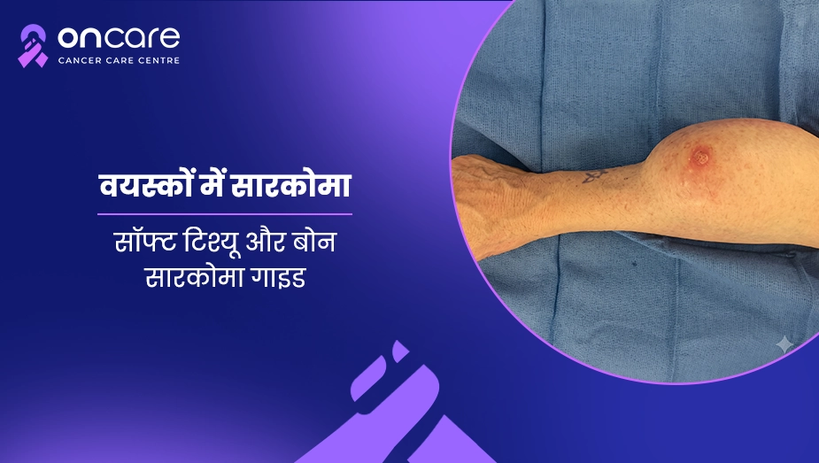 वयस्कों में सारकोमा