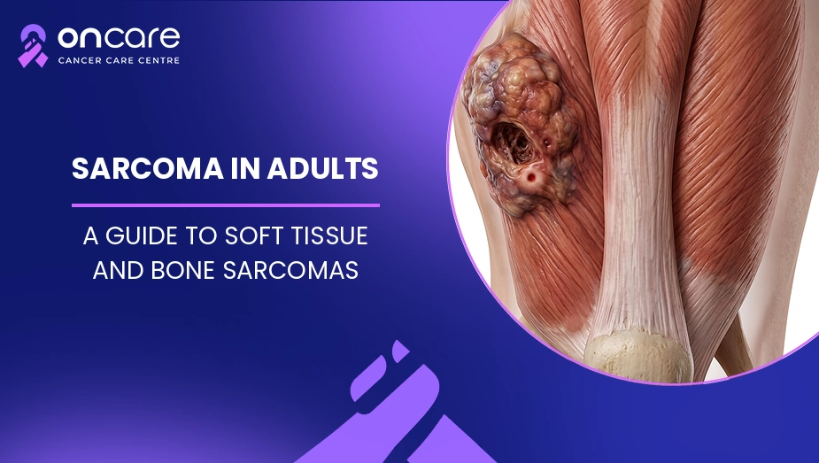 Sarcoma in Adults