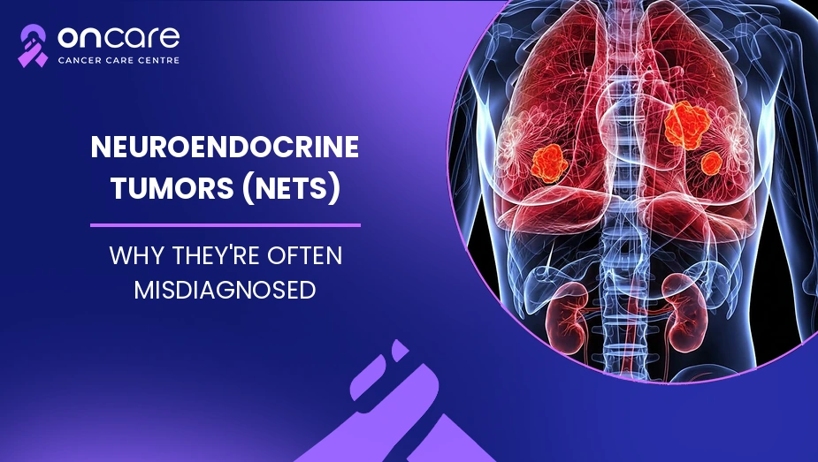 Neuroendocrine Tumors (NETs)