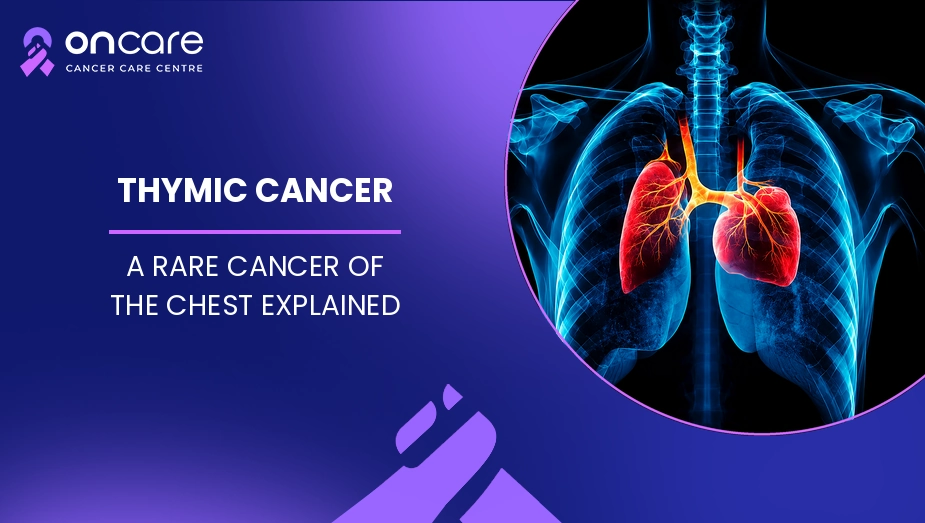 Thymic Cancer