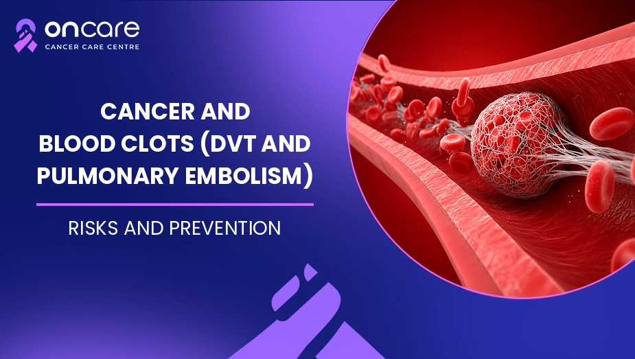 Cancer and Blood Clots
