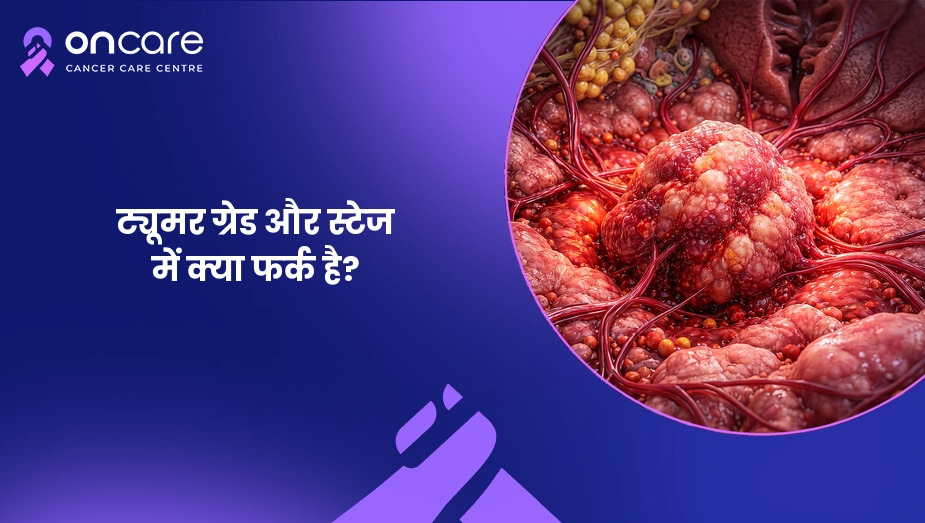 ट्यूमर ग्रेड और स्टेज में क्या फर्क है?
