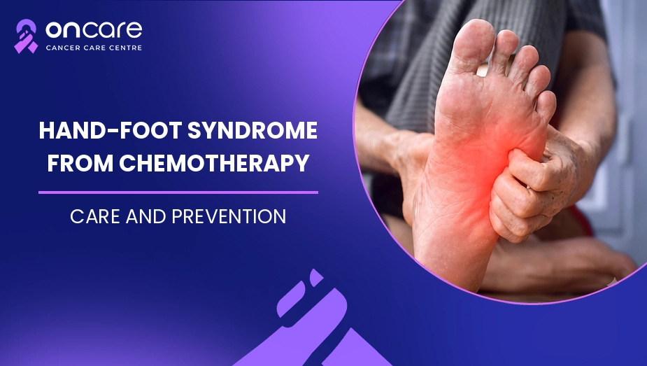 Hand-Foot Syndrome From Chemotherapy