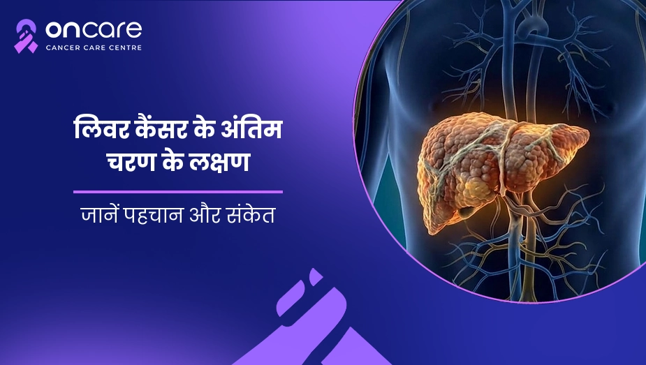 लिवर कैंसर के अंतिम चरण के लक्षण