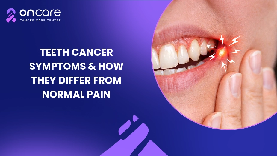 Teeth Cancer Symptom