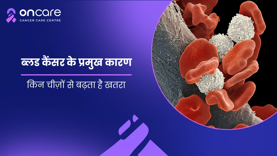 ब्लड कैंसर के प्रमुख कारण