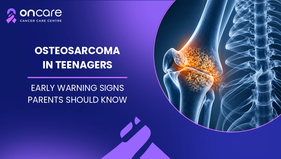 Osteosarcoma in Teenagers