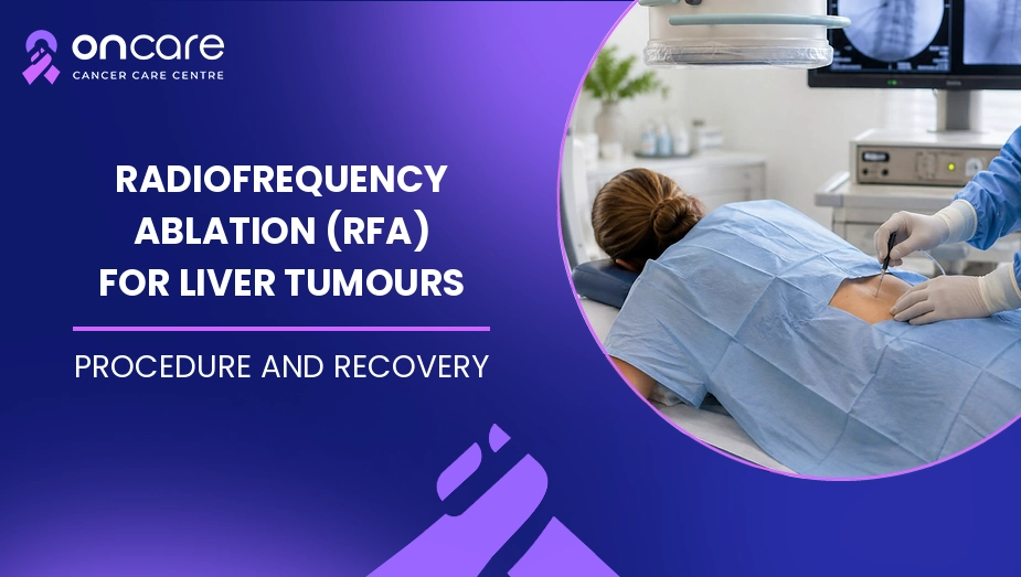 Radiofrequency Ablation (RFA) for Liver Tumours