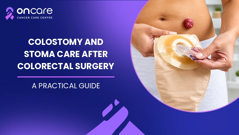 Colostomy and Stoma Care After Colorectal Surgery