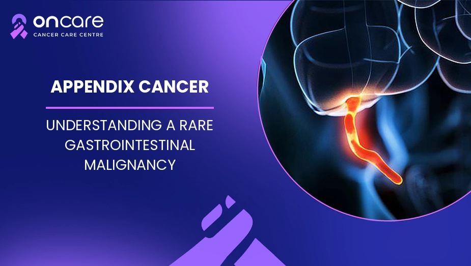 Appendix Cancer