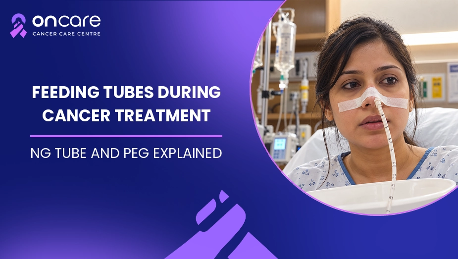Feeding Tubes During Cancer Treatment