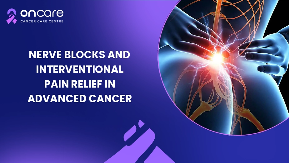 nerve blocks cancer pain relief