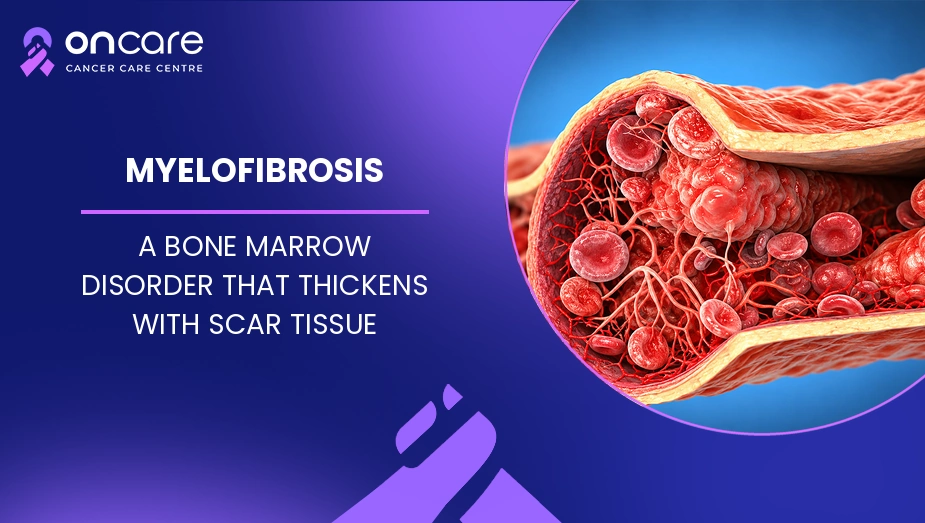 Myelofibrosis