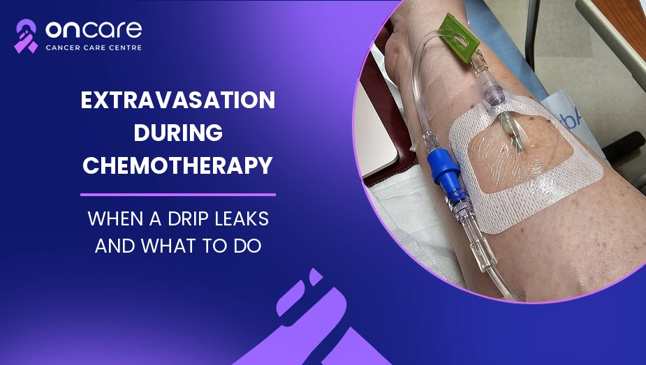 Extravasation During Chemotherapy