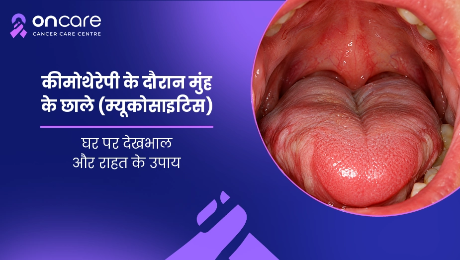 mouth ulcer during chemotherapy in hindi
